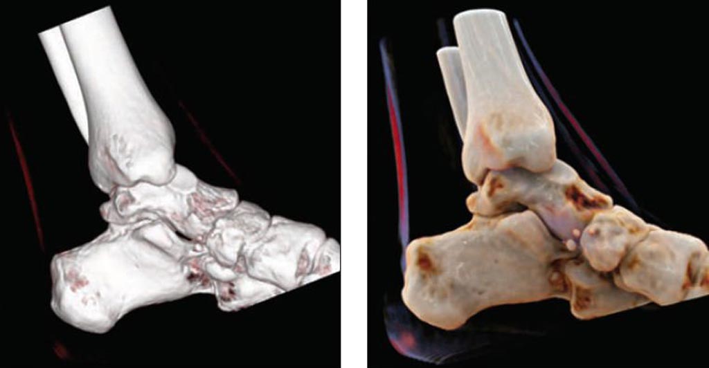 Image: Volume-rendered image (L), compared to a cinematically rendered image (R) (Photo courtesy of AJR).