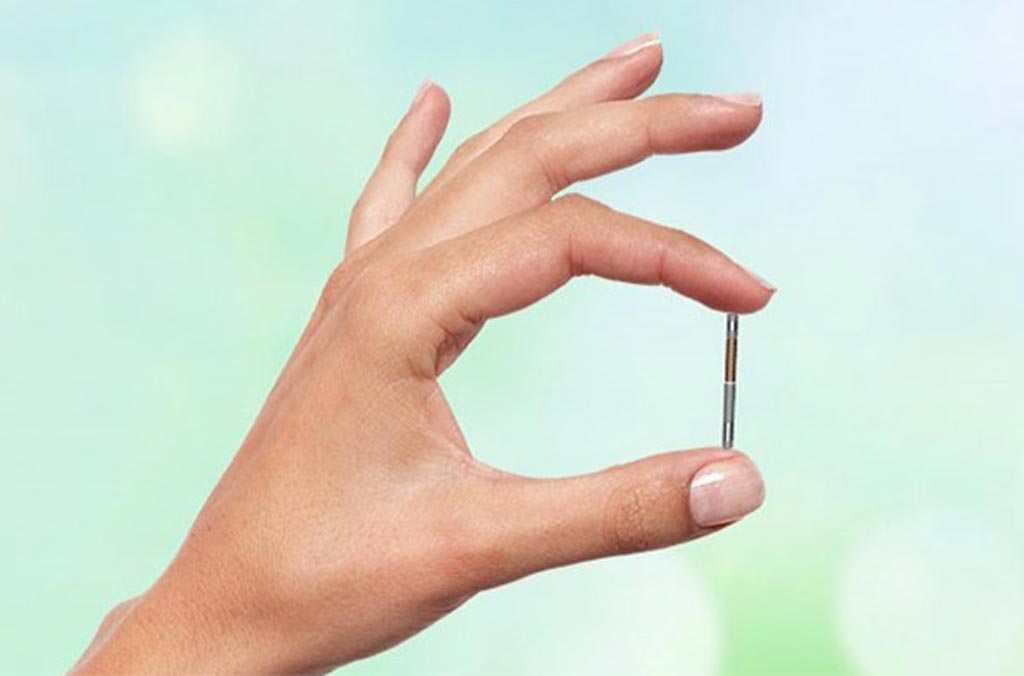 Image: A small implantable neurostimulator helps control overactive bladders (Photo courtesy of BlueWind Medical).