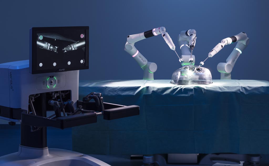 Image: A four-wristed surgical robot mimics the human hand (Photo courtesy of CMR Surgical).