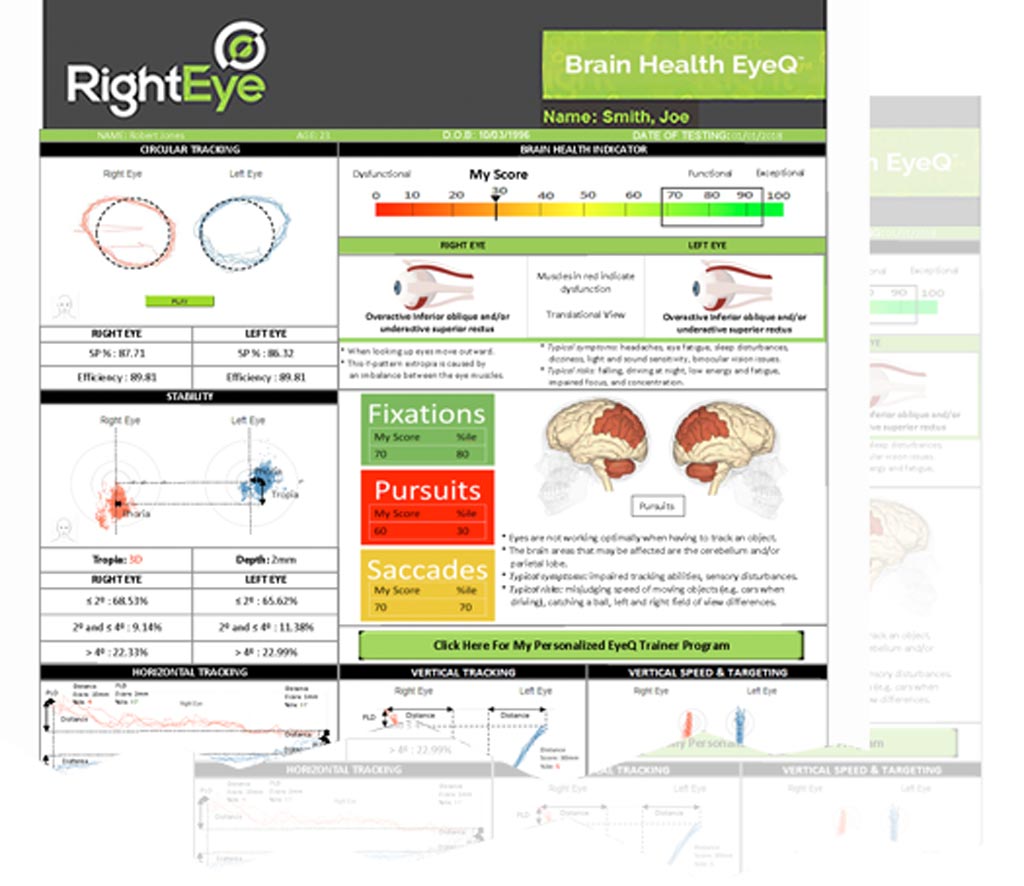 Image: Eye movement tracking can help detect neurological issues (Photo courtesy of RightEye).