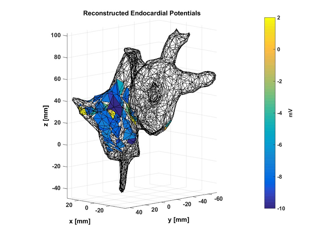 Image: Doctors can use these noninvasive maps of electrochemical potentials inside a patient\'s heart to localize the source of an abnormal heart rhythm (Photo courtesy of Abhejit Rajagopal).