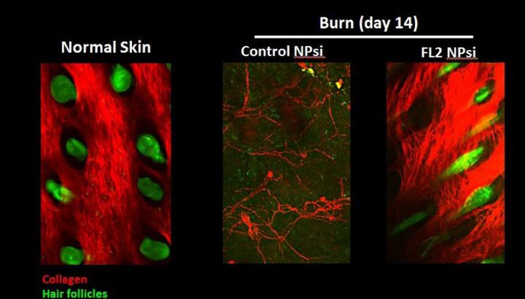 Image: Inhibiting cleaving FL2 enzymes help wounds repair better and faster (Photo courtesy of Albert Einstein College of Medicine).