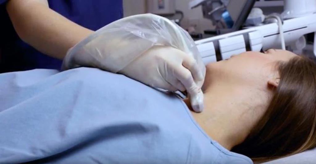 Image: The Envision ultrasound probe cover (Photo courtesy of CIVCO Medical Solutions).