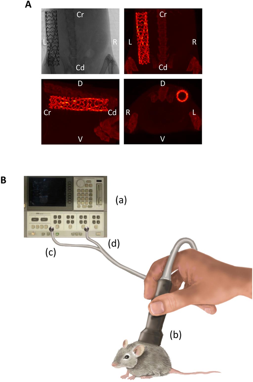 Image: Micro-CT images of the stent (A) and the MWS setup (B) (Photo courtesy of Carolina Gálvez-Montón).