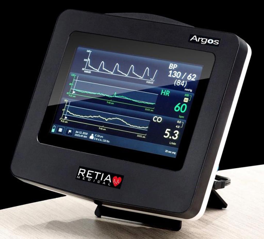 Image: A new monitor accurately measures cardiac output (Photo courtesy of Retia Medical).