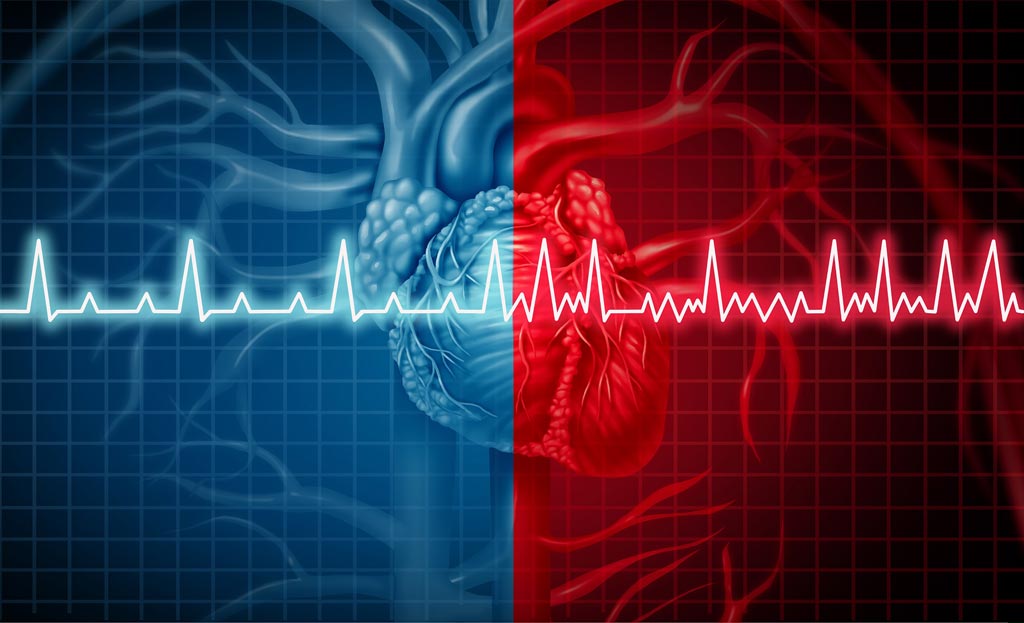 Image: New research shows NOACs are preferred over warfarin as an anticoagulant in AF (Photo courtesy of 123RF).