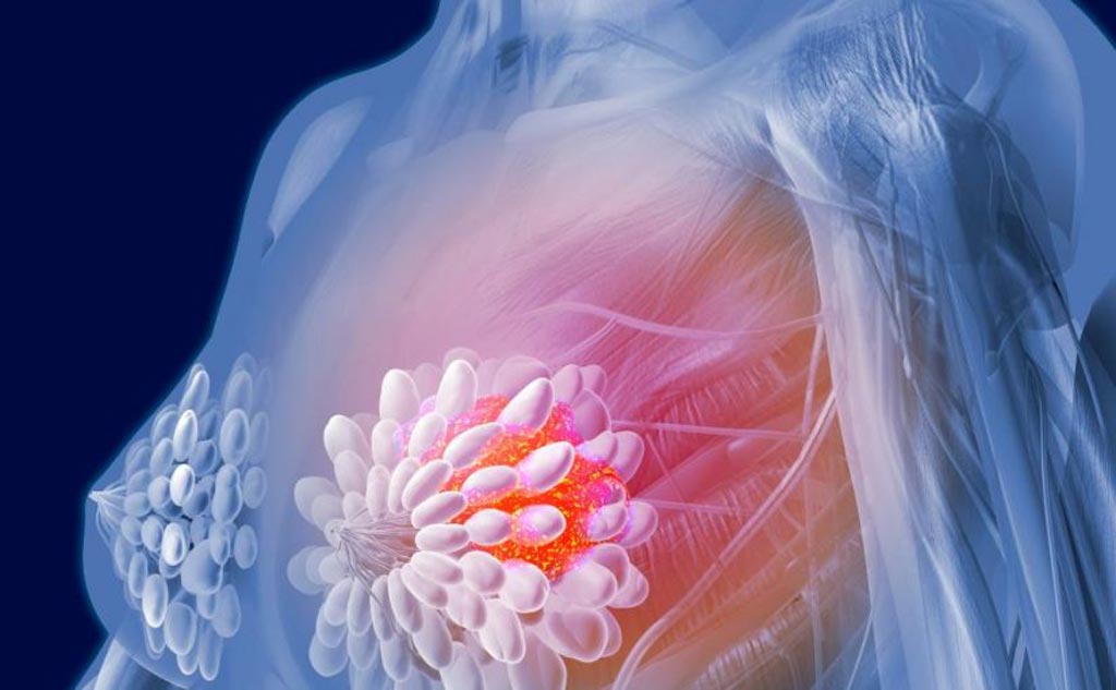 Image: The global breast cancer diagnostics market is anticipated to surpass USD 2 billion in revenues by the end of 2022 (Photo courtesy of Shutterstock). Image: The global breast cancer diagnostics market is anticipated to surpass USD 2 billion in revenues by the end of 2022 (Photo courtesy of Shutterstock).