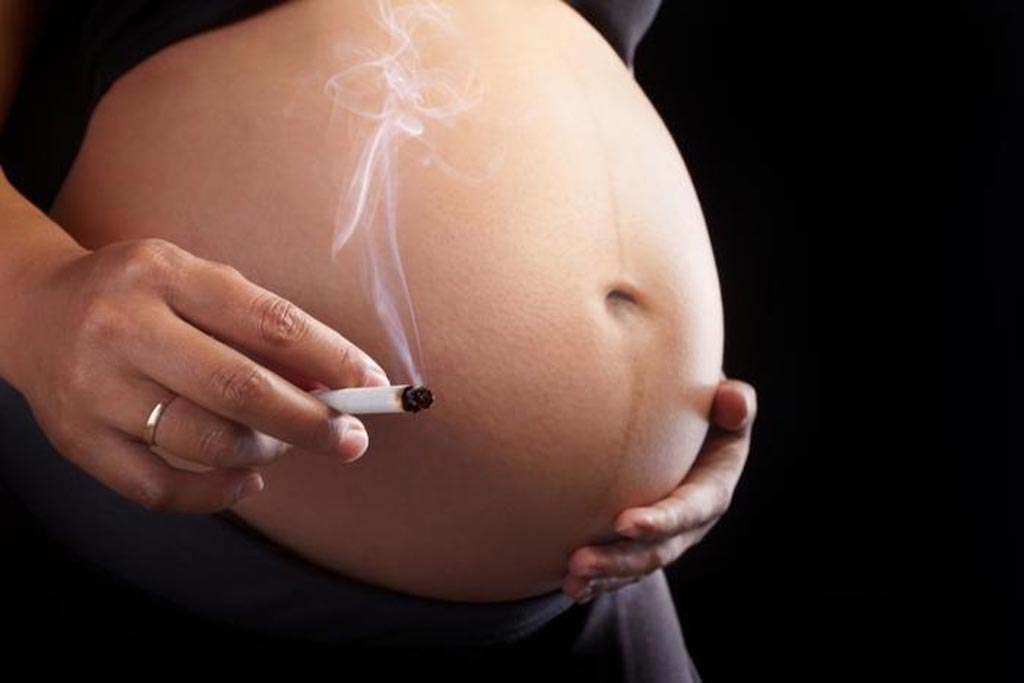 Image: A new study shows that ttopping smoking before and during pregnancy reduces preterm delivery risk (Photo courtesy of Getty Images). Image: A new study shows that ttopping smoking before and during pregnancy reduces preterm delivery risk (Photo courtesy of Getty Images).