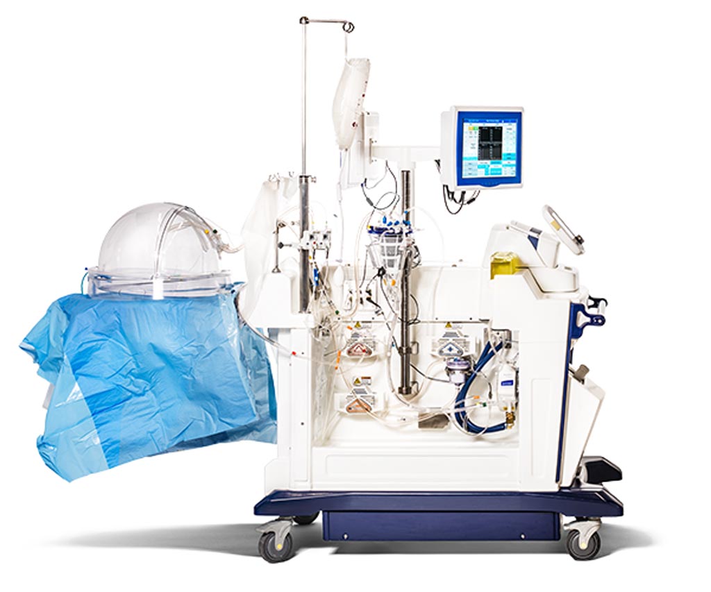 Image: The sophisticated cart is designed to maintain lungs viable for transplant (Photo courtesy of Xvivo Perfusion).