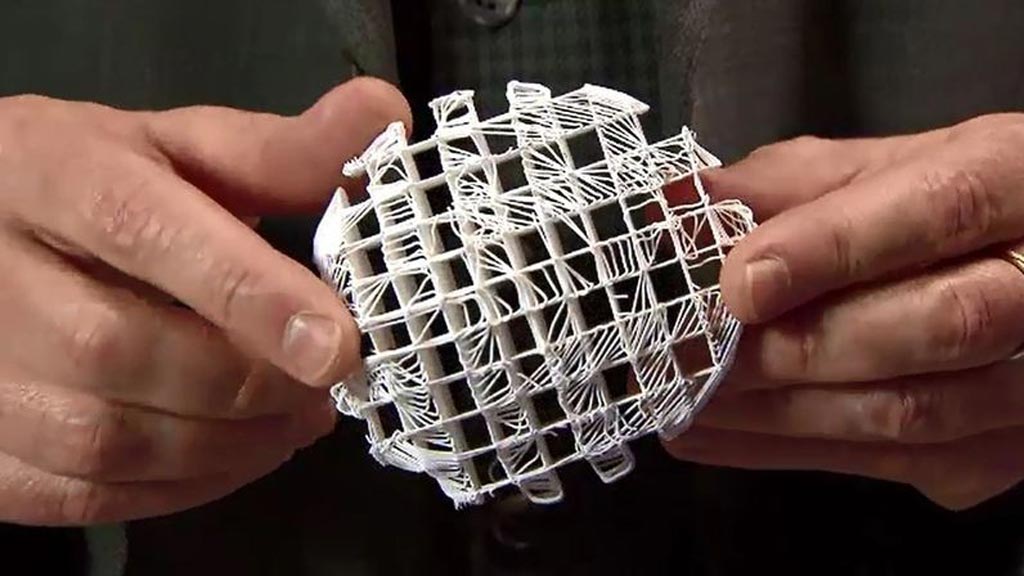Image: Researchers assert that a 3D-printed scaffold may act as a framework and allow cancer patients to grow breast tissue (Photo courtesy of All3DP).