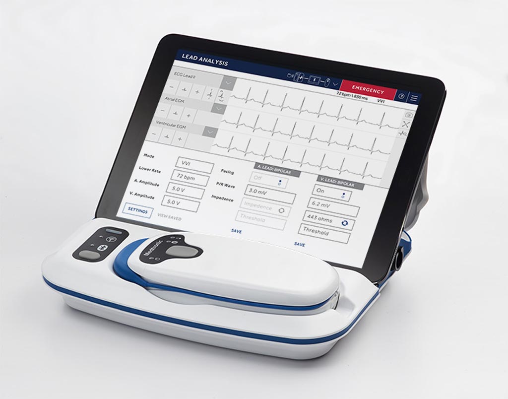 Image: The CareLink SmartSync, with base station, telemetry head and iPad controller (Photo courtesy of Medtronic).