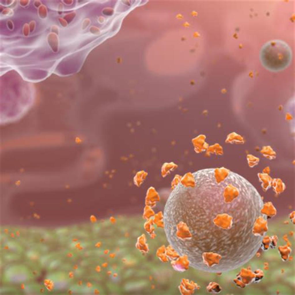 Image: The presence of alpha defensin in synovial fluid indicates PJI (Photo courtesy of Zimmer Biomet).