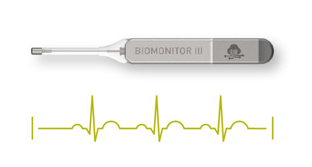 Image: The BIOMONITOR III ICM (Photo courtesy of BIOTRONIK).