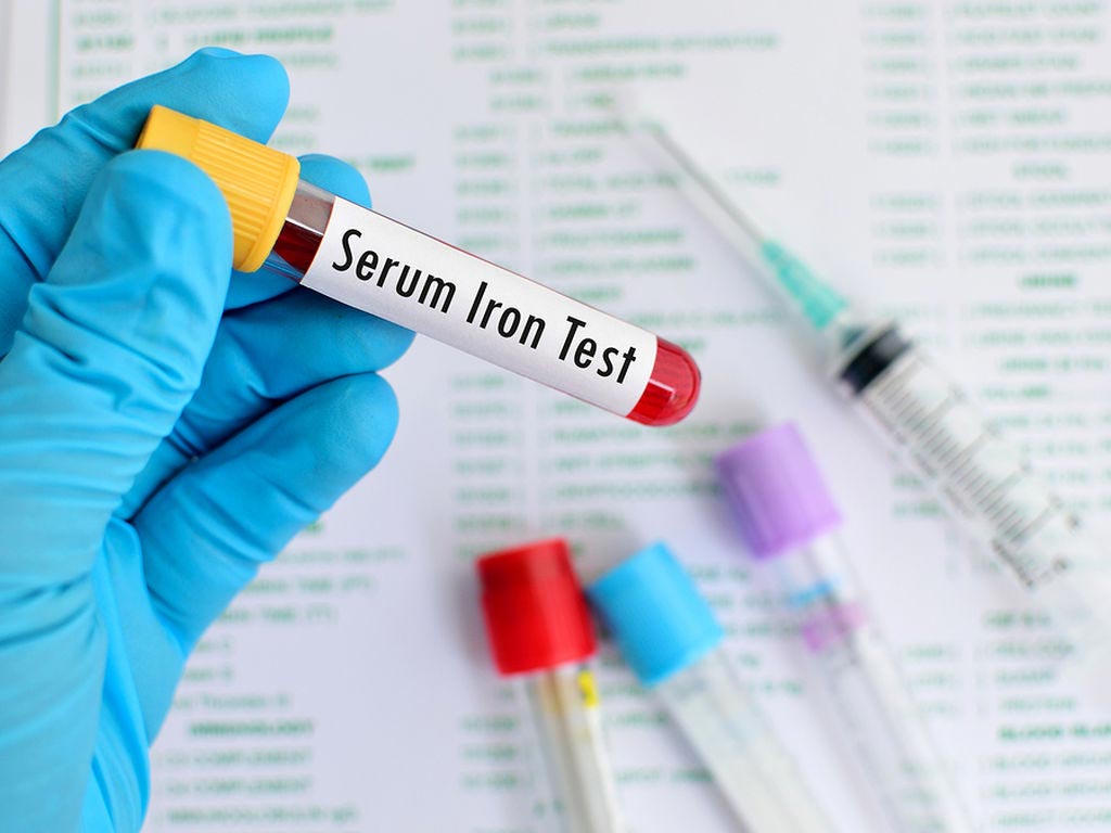 Image: A new study claims iron levels can influence VTE and infection risk (Photo courtesy of 123rf).
