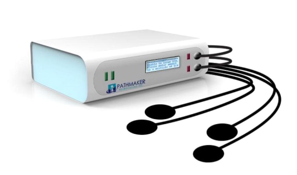 Image: A new device suppresses hyperexcitable spinal neurons (Photo courtesy of PathMaker Neurosystems).