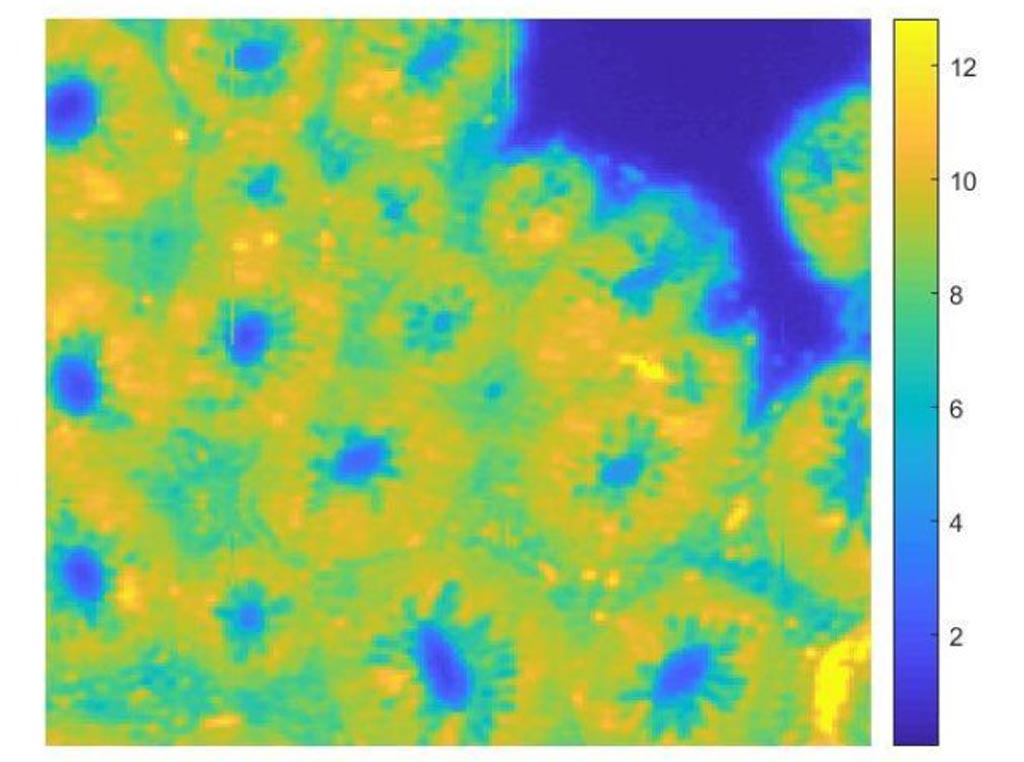 Image: A new study asserts that FTIR chemical imaging can help identify colon cancer more accurately (Photo courtesy of ICL). Image: A new study asserts that FTIR chemical imaging can help identify colon cancer more accurately (Photo courtesy of ICL).