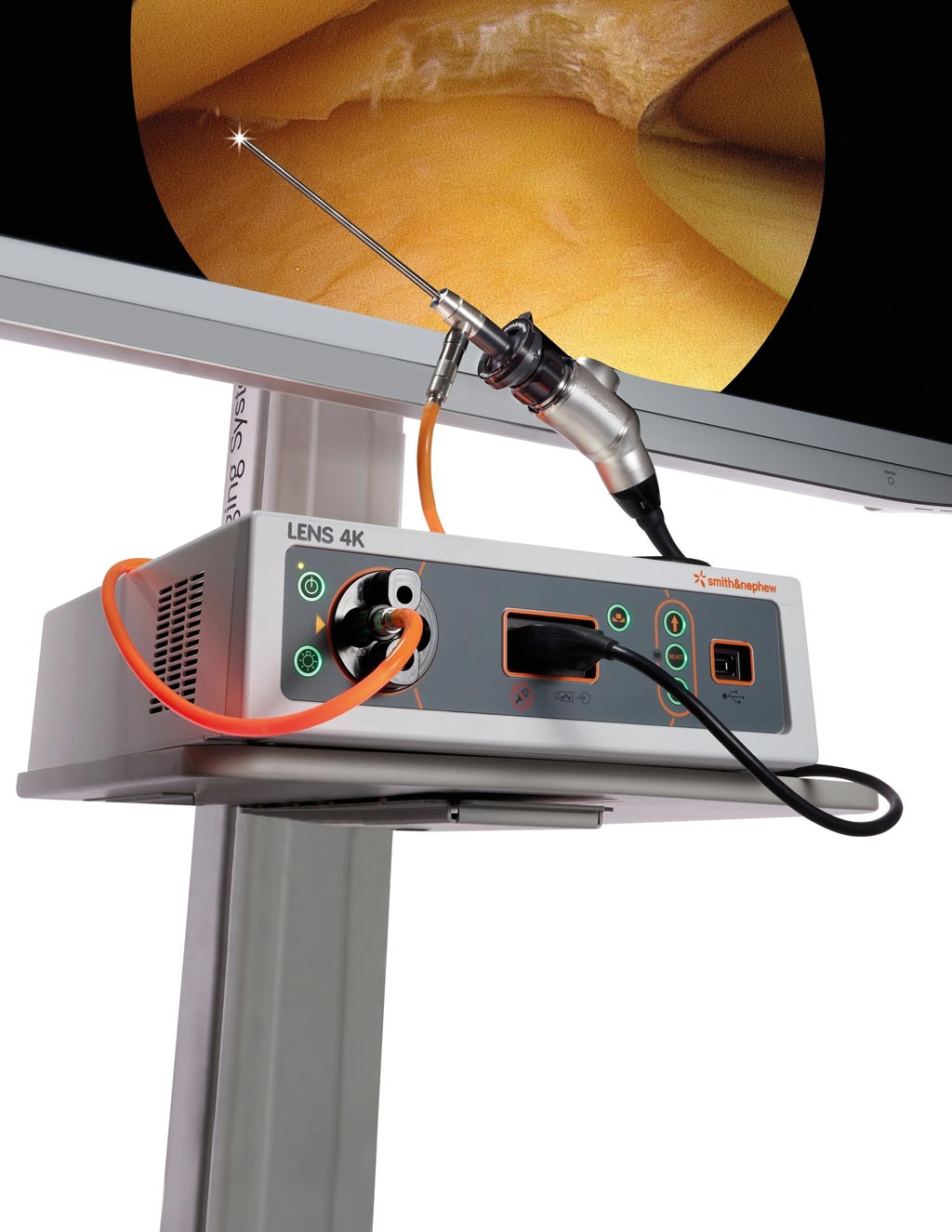 Image: The LENS 4K surgical imaging system (Photo courtesy of Smith+Nephew). Image: The LENS 4K surgical imaging system (Photo courtesy of Smith+Nephew).