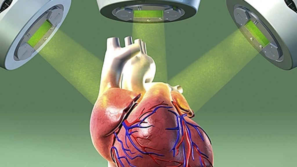 Image: According to a new study, RT can offer hope the VT patients who have exhausted other options (Photo courtesy of SPL).