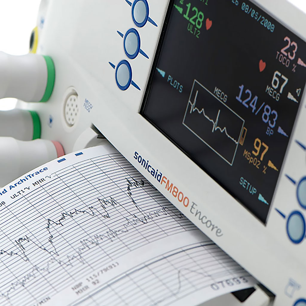 Image: Sonicaid FM800 Encore (Photo courtesy of Huntleigh Healthcare)