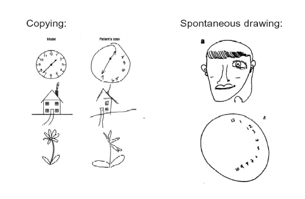 Image: Examples of visual aspects of USN (Photo courtesy of StackExchange)