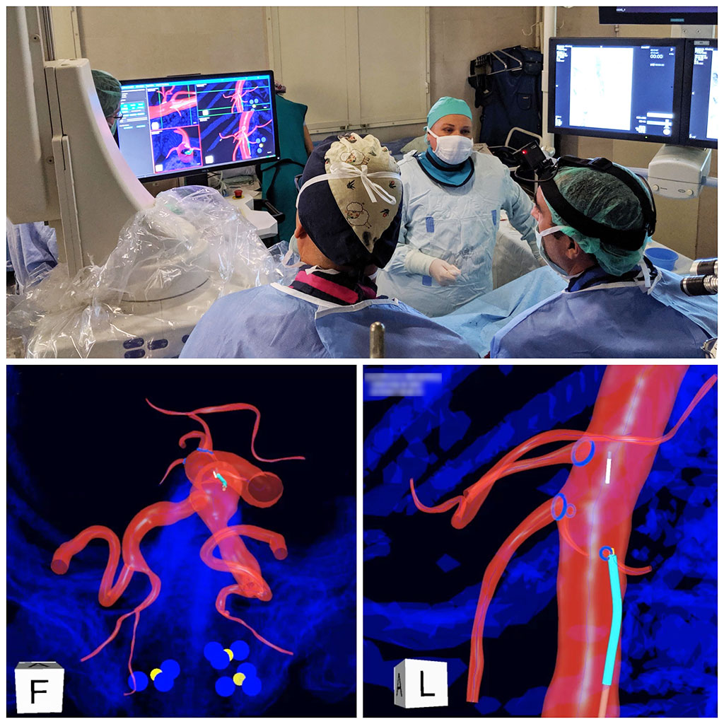 Image: The IOPS system provides a radiation-free method to navigate catheters and guidewires (Photo courtesy of Centerline Biomedical)