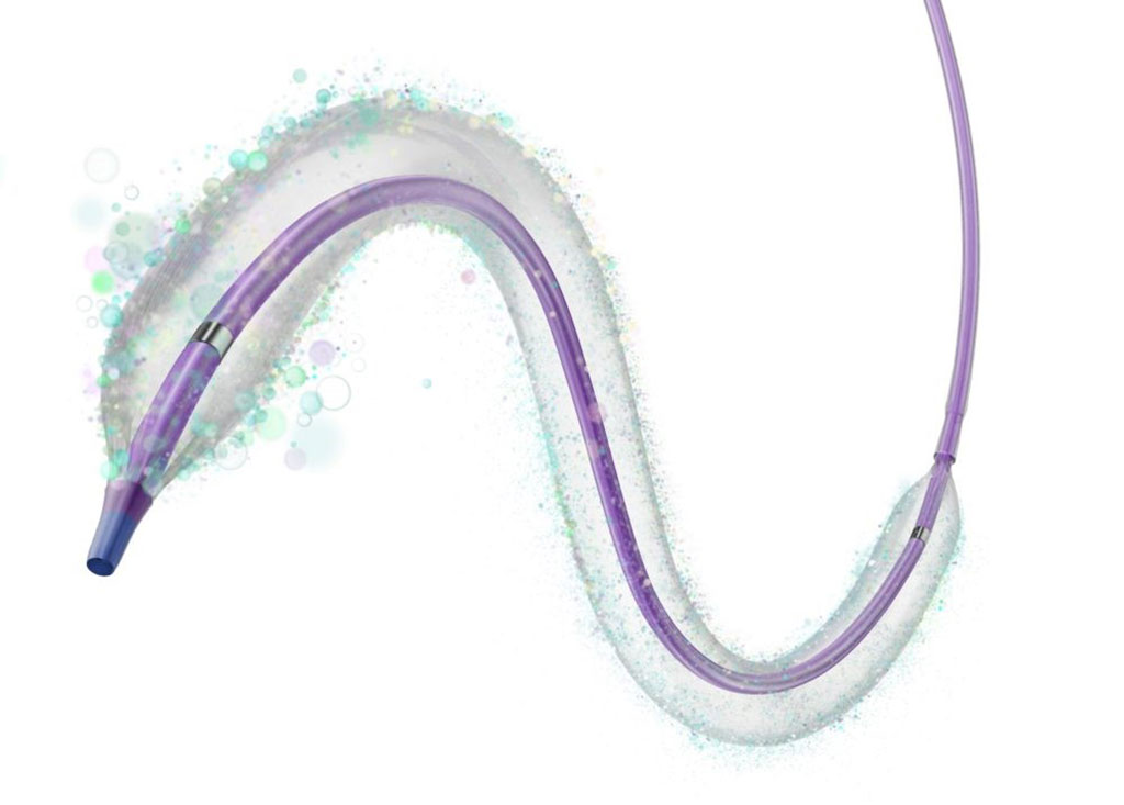 Image: The IN.PACT paclitaxel DCB maintains failing arteriovenous dialysis access (Photo courtesy of Medtronic)