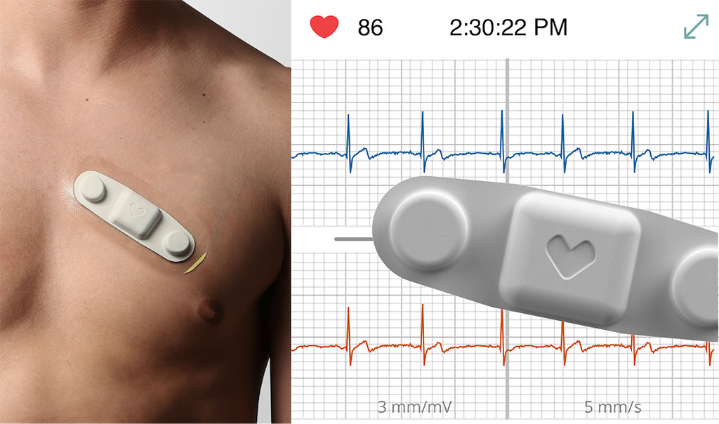 Image: A small patch help monitor patients vital signs remotely (Photo courtesy of VivaLNK)