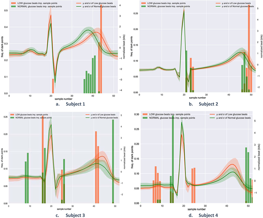 Image: ECG heartbeat segments help identify hypoglycemia events (Photo courtesy of University of Warwick)