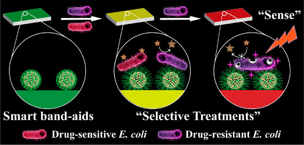 Image: A color-changing bandage treats infections (Photo courtesy of CAS)