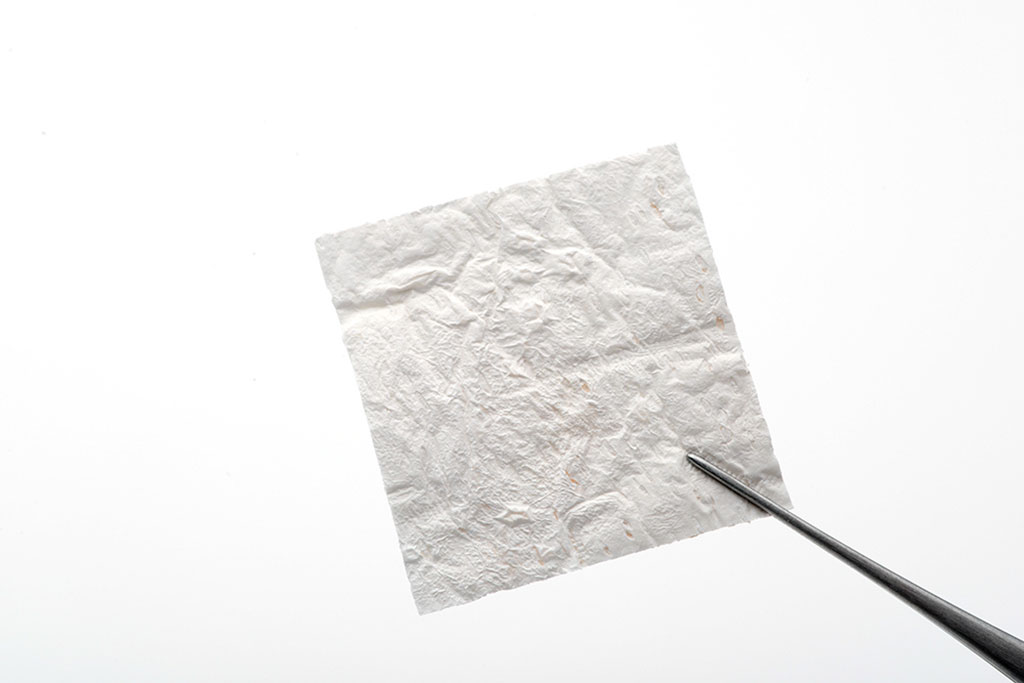 Image: A sheet of the StimLabs Corplex allograft (Photo courtesy of Stimlabs)