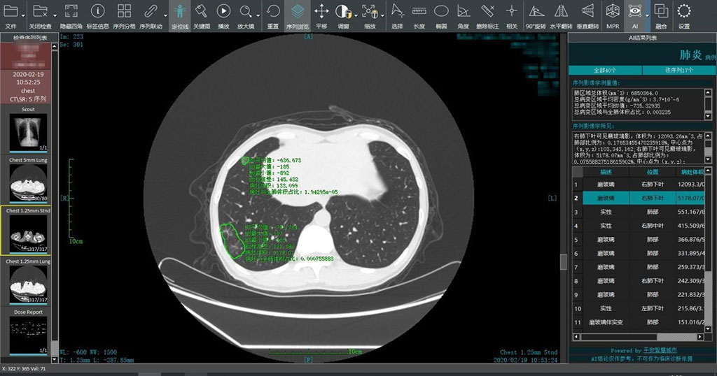 Image: A smart image-reading system generates rapid analyses in epidemic areas (Photo courtesy of Ping An Smart Healthcare)