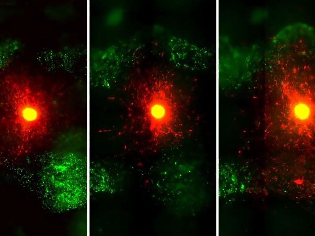 Image: A new imaging technique enables the study of 3D-printed brain tumors (Photo courtesy of RPI) Image: A new imaging technique enables the study of 3D-printed brain tumors (Photo courtesy of RPI)
