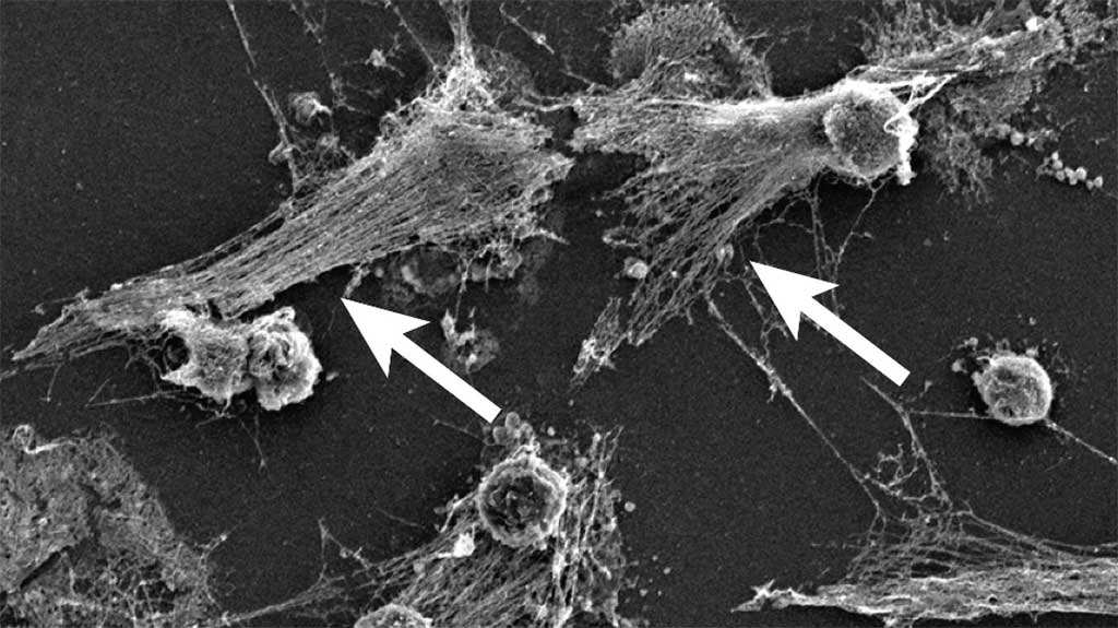 Image: International consortium investigates overactive immune cells as cause of COVID-19 deaths (Photo courtesy of McGill University)