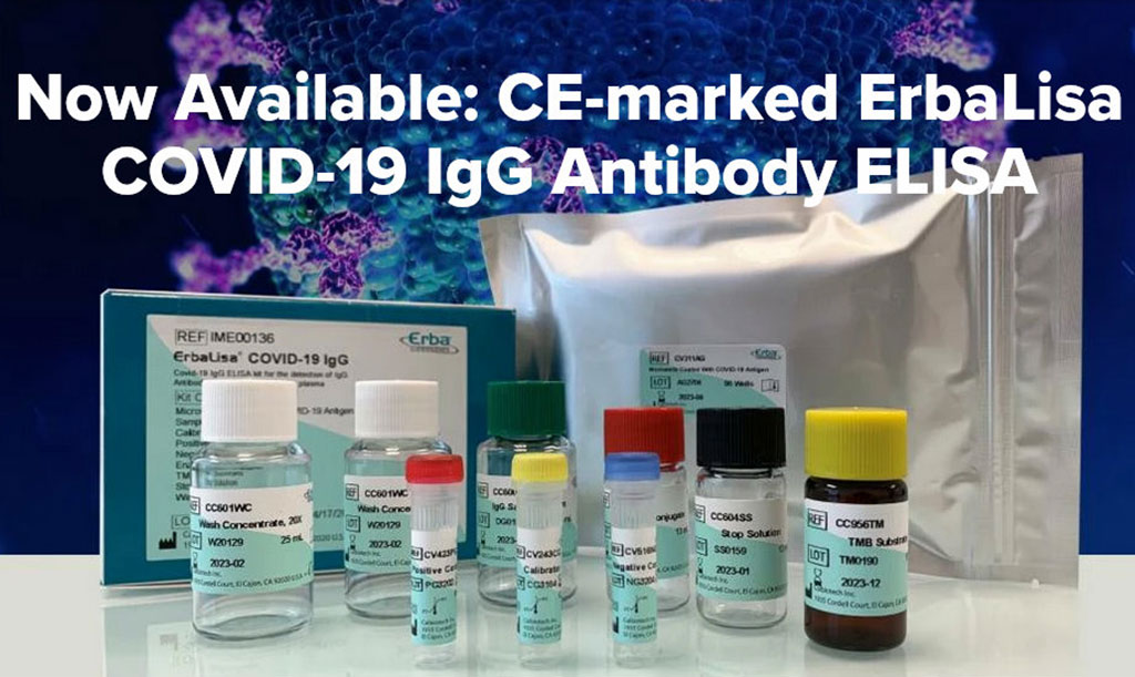 Image: ErbaLisa COVID-19 IgG Antibody ELISA (Photo courtesy of Erba Mannheim)