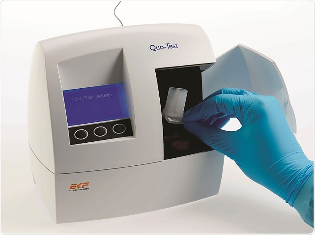 Image: EKF’s Quo-Test analyzer (Photo courtesy of EKF Diagnostics)