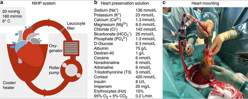 Image: Schematic of the NIHP system (Photo courtesy of Nature Communications)