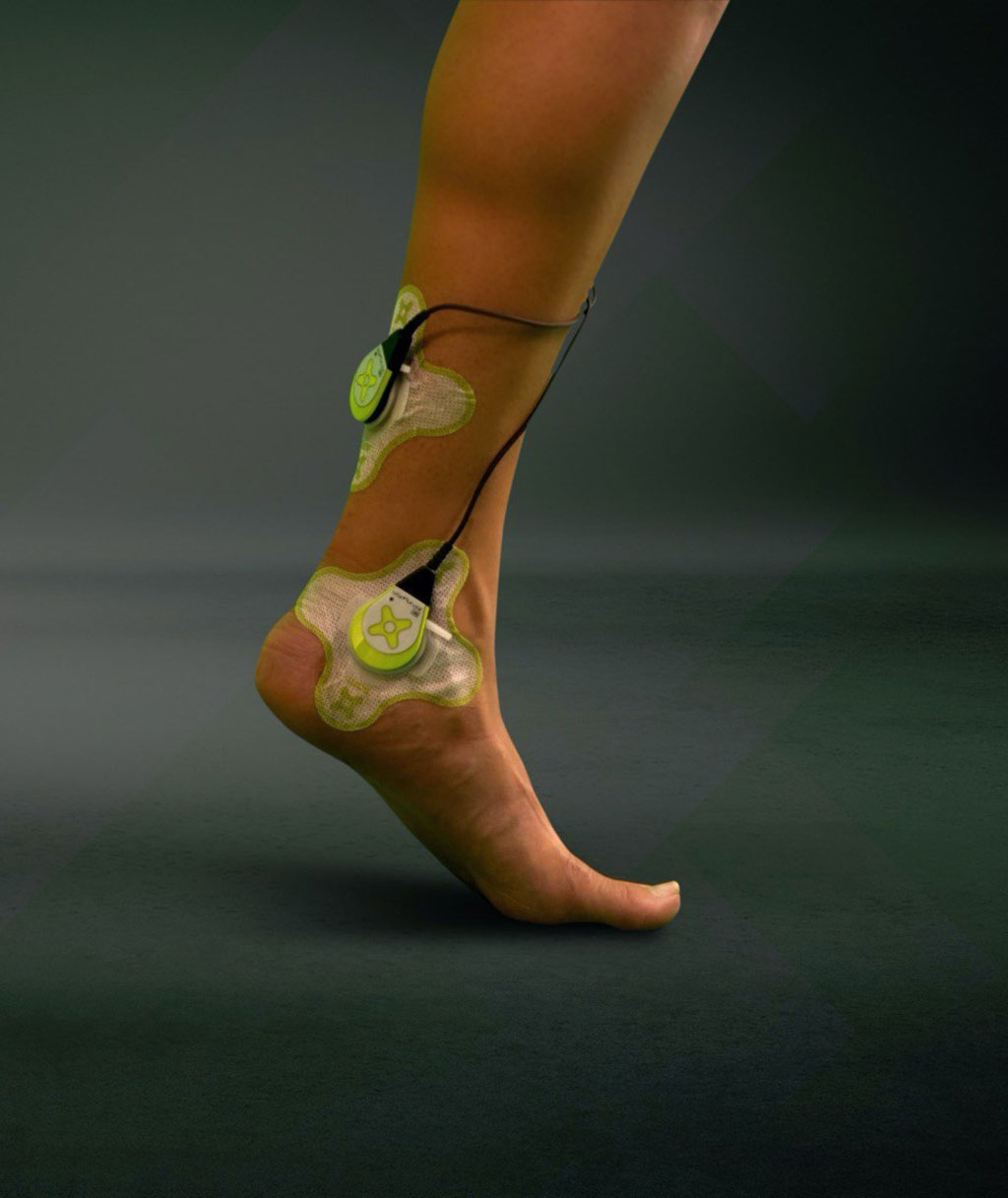 Image: The sam applied to Achilles tendon injury to stimulate collagen-matrix rebuilding (Photo courtesy of ZetrOZ Systems)