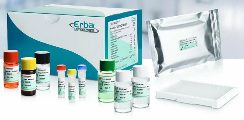 Image: ErbaLisa COVID-19 IgM ELISA kit (Photo courtesy of Erba Mannheim)