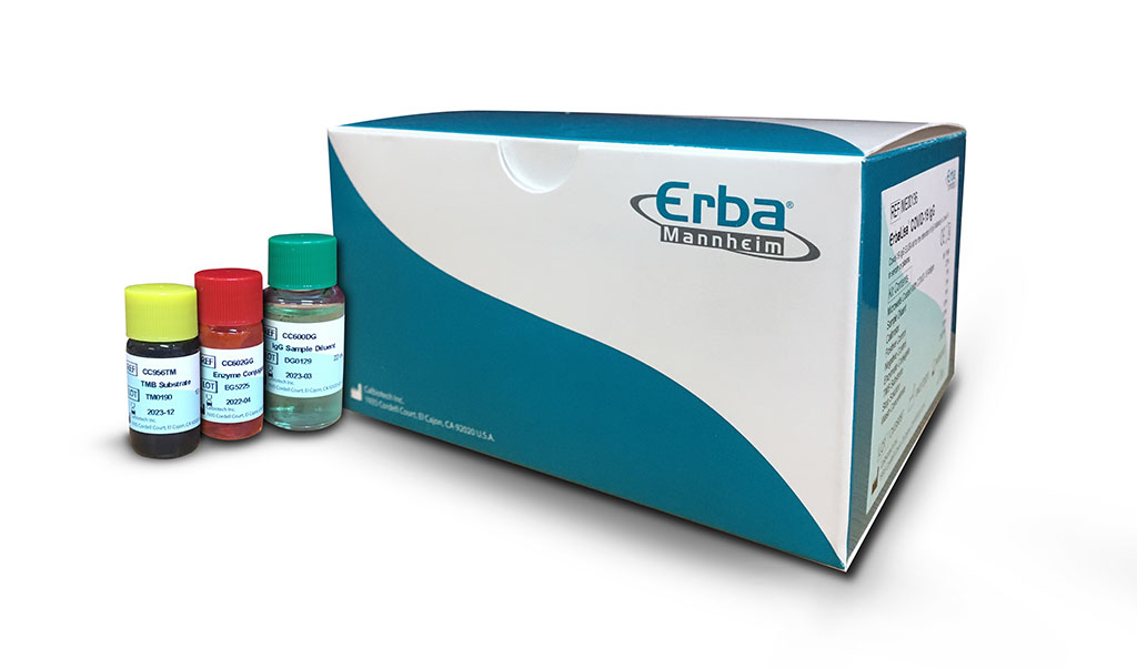 Image: ErbaLisa COVID-19 IgM ELISA kit (Photo courtesy of Erba Mannheim)