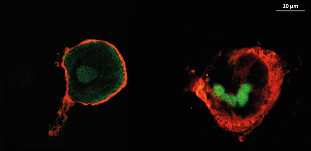 Image: Macrophages on implants coated with heparin (L) and HA (R) (Photo courtesy of Hala Al Khoury / MLU)