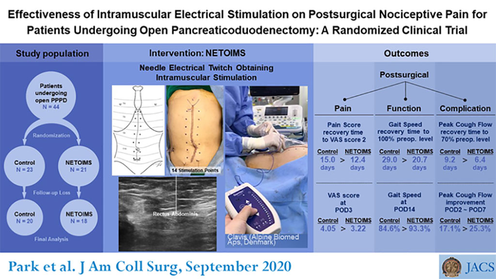 Image: Intramuscular electrical stimulation can reduce postoperative pain (Photo courtesy of JACS)