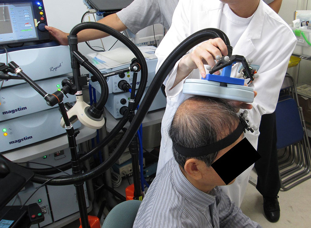 Image: Stimulating the brain with rapid magnetic pulses helps determine language center locations (Photo courtesy of Kazuya Motomura/ Nagoya University)