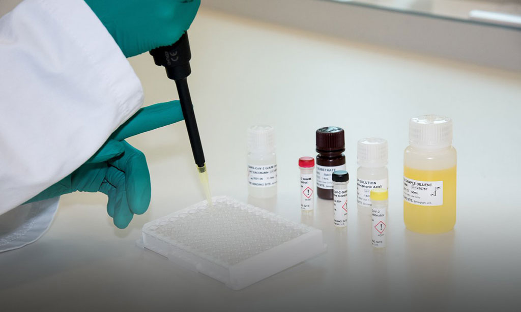 Image: New CE-Marked ELISA Test Detects COVID-19 Antibodies in Recently Infected People with Mild Symptoms (Photo courtesy of The Binding Site)