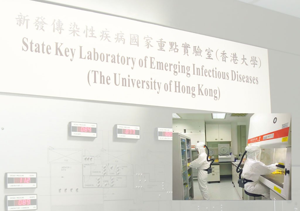 Image: China Begins Human Trial for First COVID-19 Nasal Spray Vaccine (Photo courtesy of University of Hong Kong)