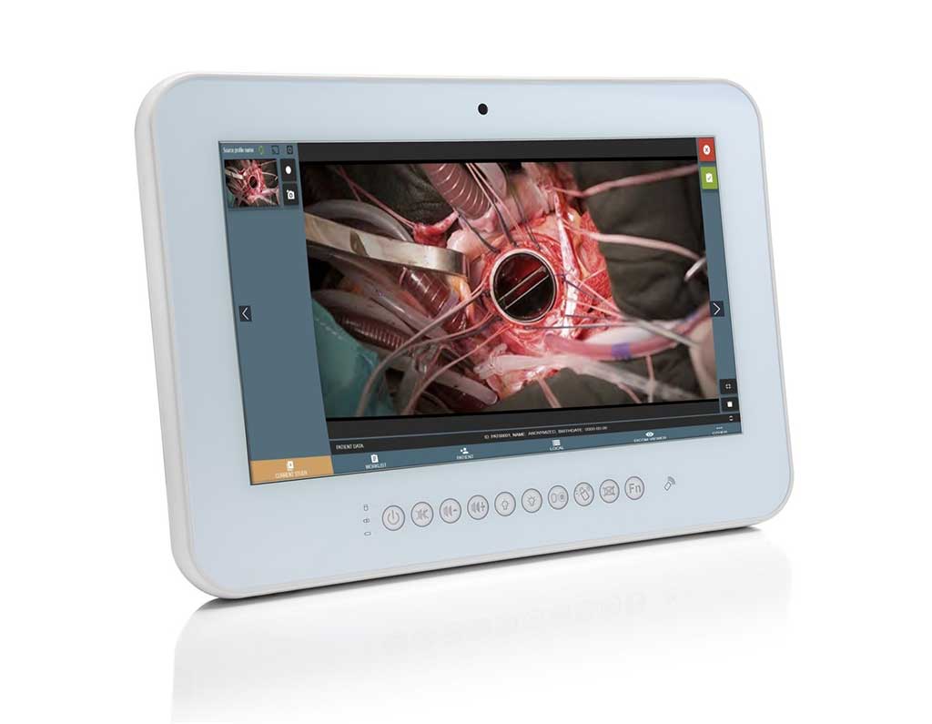 Image: The TeleRay Surgical Endoscope Recorder (Photo courtesy of Nautilus Medical Technologies)