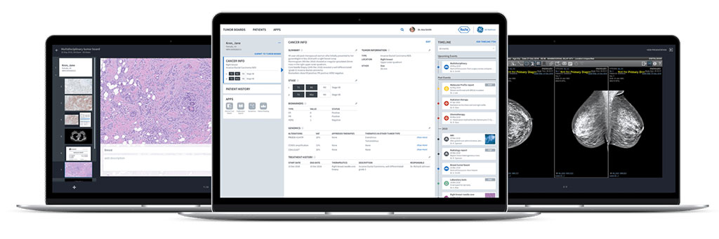 Image: A digitized tumor board aggregates  all relevant patient data (Photo courtesy of Roche)