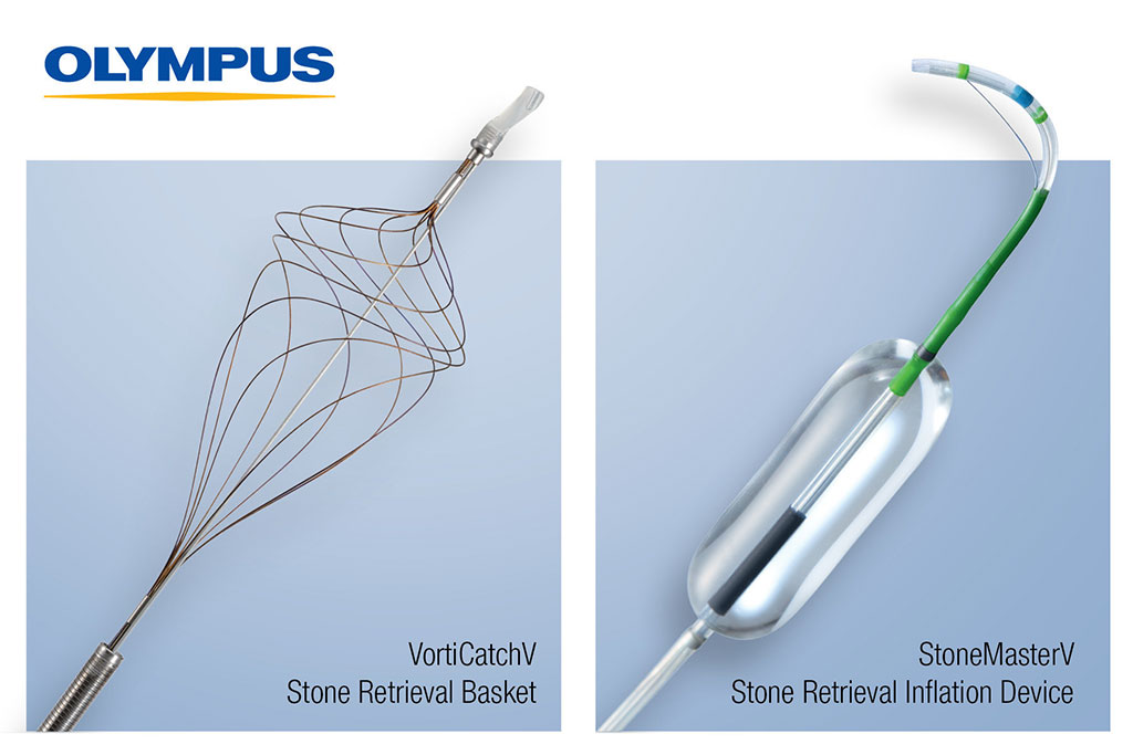 Image: The StoneMasterV and VorticCatchV ECRP devices (photo courtesy of Olympus)