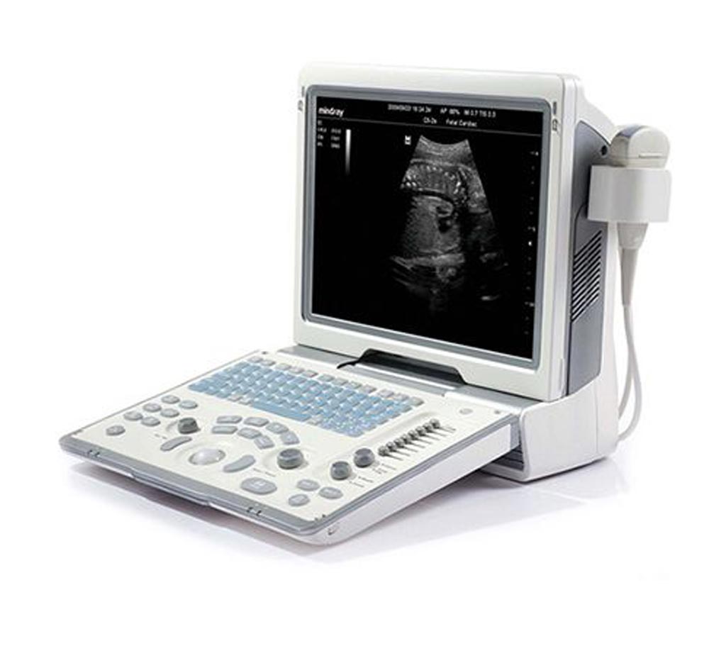 Image: Mindray DP-50 Digital Ultrasonic Diagnostic Imaging System (Photo courtesy of Mindray)