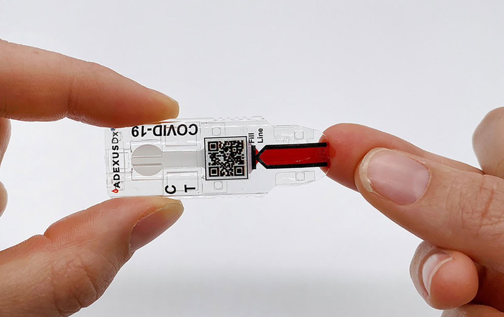 Image: ADEXUSDx® COVID-19 Test (Photo courtesy of NOWDiagnostics, Inc.)