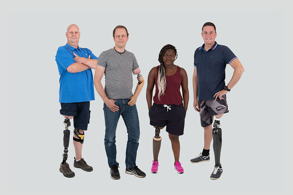 Image: A prosthesis that connects directly to the leg stump helps amputee rehab (Photo courtesy of Integrum)